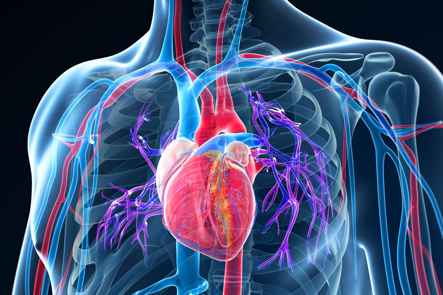 What Is Cardiovascular Disease Stroke